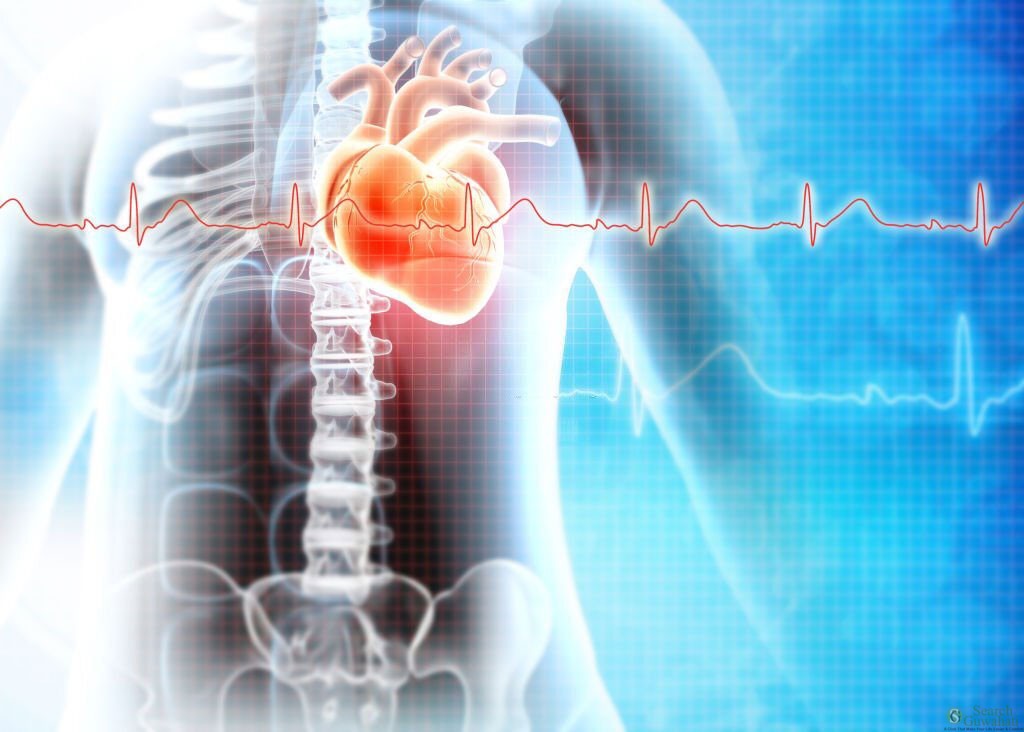 List of Top Cardiologist Doctor in Guwahati